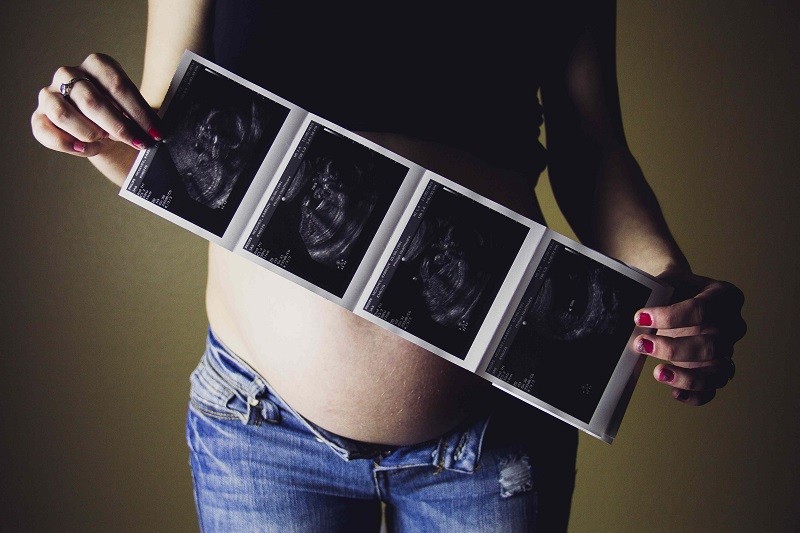 Pregnant women with ultrasound scan image bycassidy rowell from unsplash